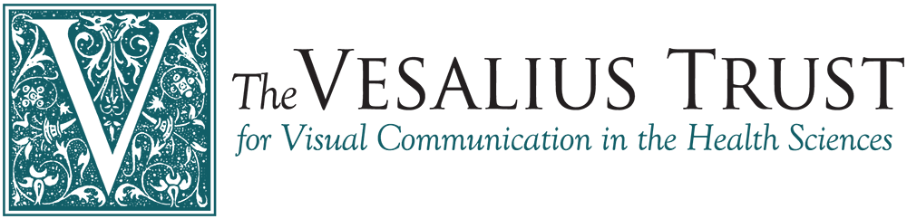 Vesalius