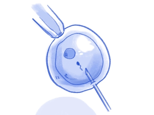 Sketch of sperm injection into an oocyte for IVF
