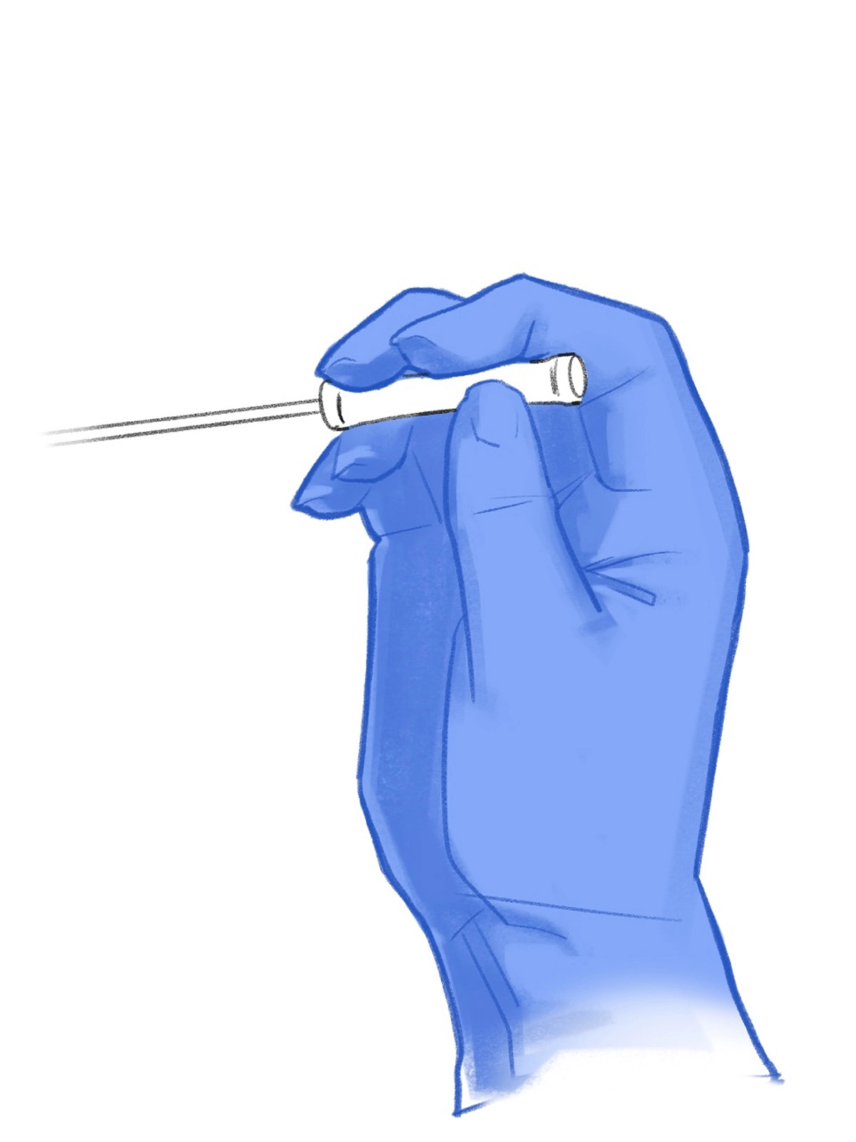 Overhand grip of needle