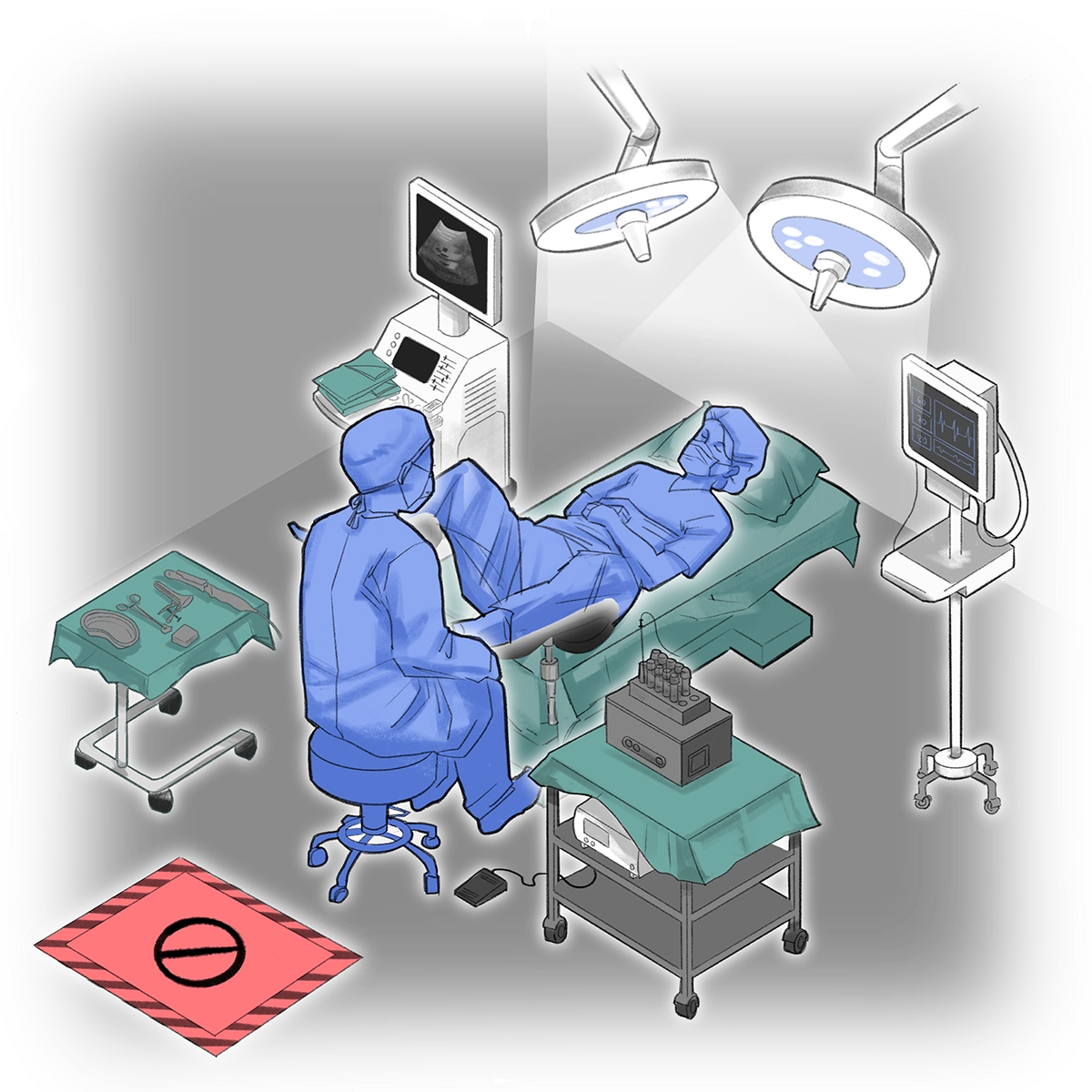 Greyscale isometric drawing of an oocyte retrieval procedure room