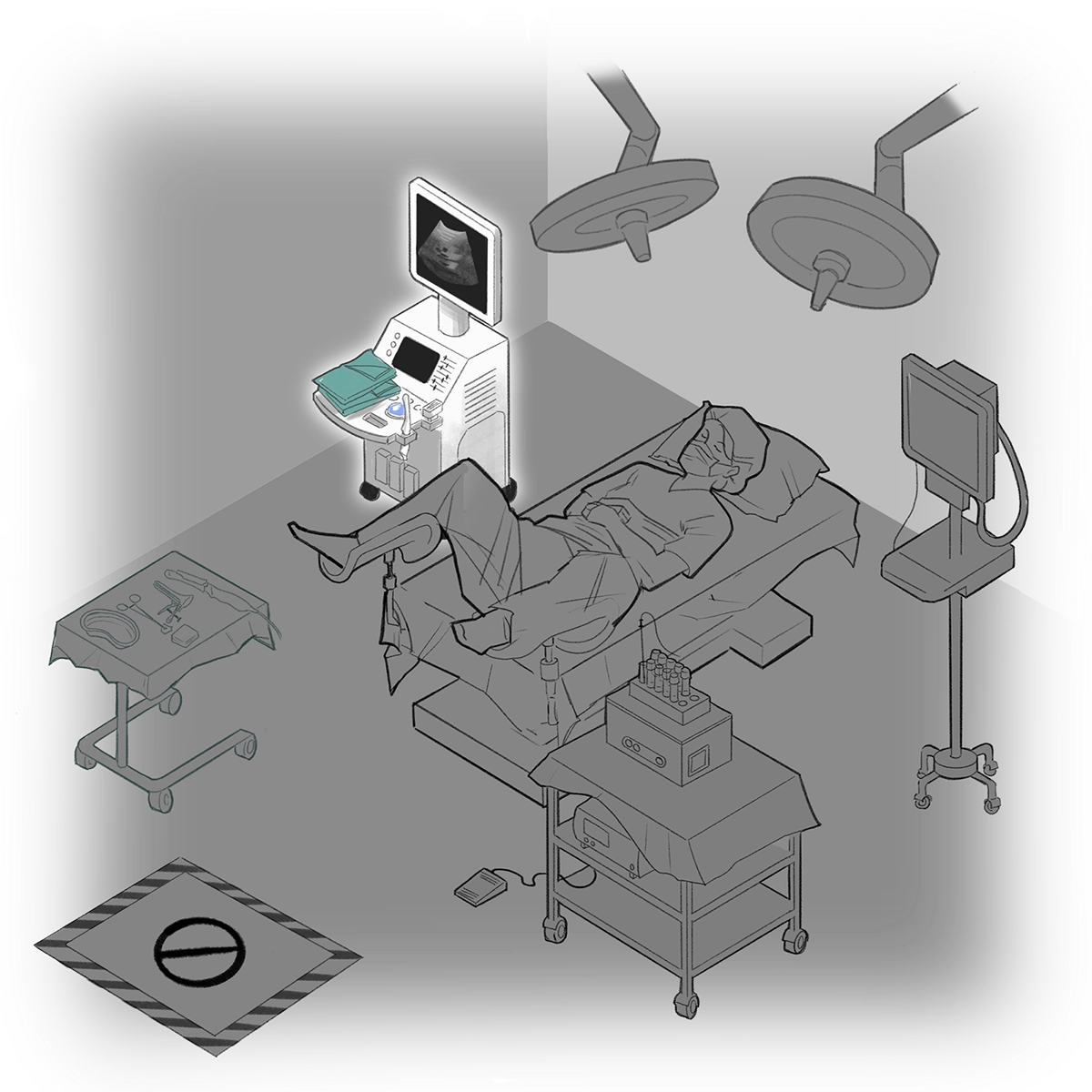 Ultrasound machine with blue towels, a transvaginal probe, and an ultrasound visible onscreen
