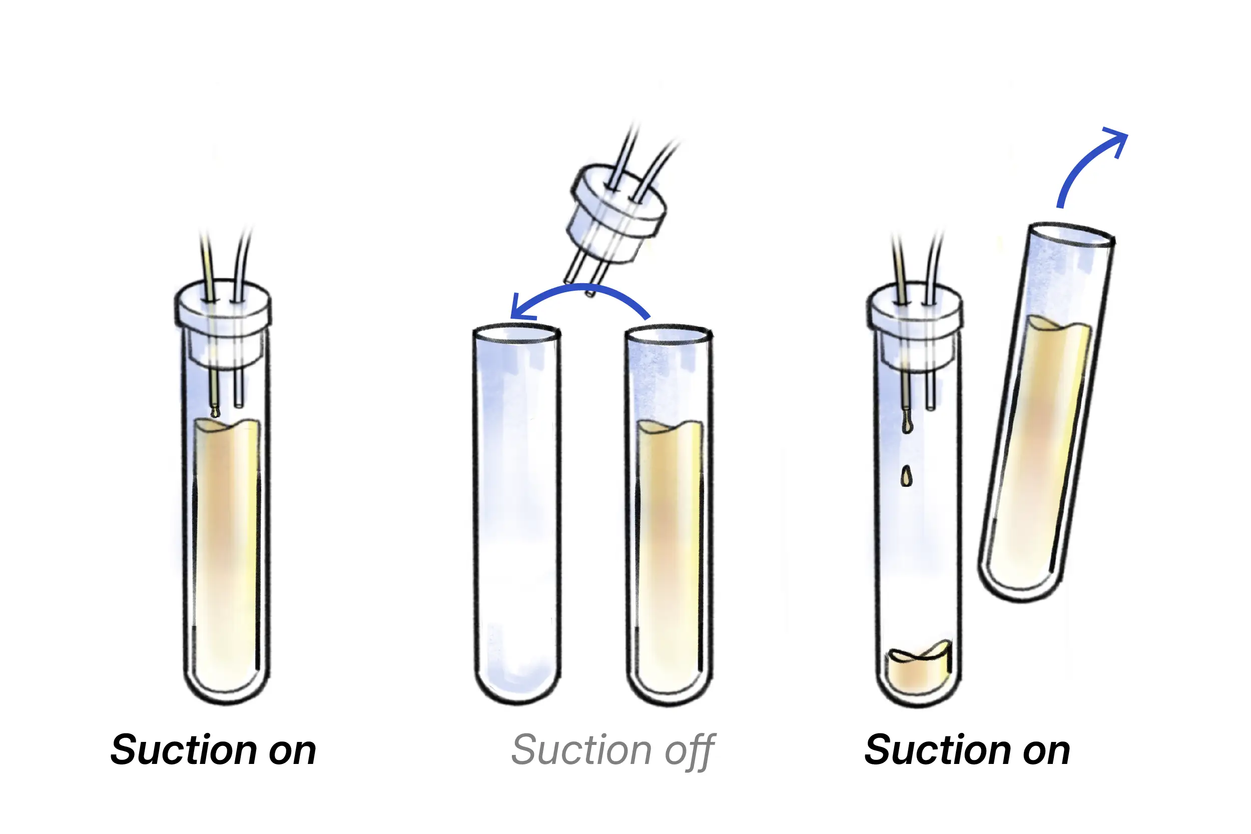 Illustration of the tube switching process, including when to turn suction on and off.